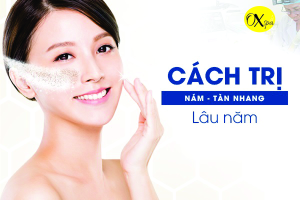 Cách trị nám tàn nhang lâu năm 