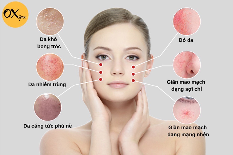 Điều trị da mụn, nám, thâm, tàn nhang, sẹo, lão hoá sớm