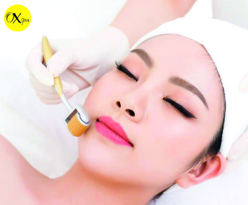 OXspa, Điều trị lỗ chân lông to bằng lăn kim