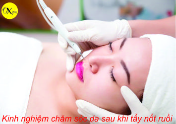 Kinh nghiệm chăm sóc da sau khi tẩy nốt ruồi