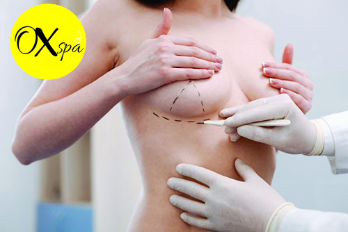 OXspa, nâng ngực bằng phương pháp nào an toàn nhất