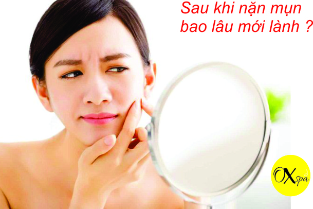 Sau khi nặng mụn bao lâu mới lành, Oxspa