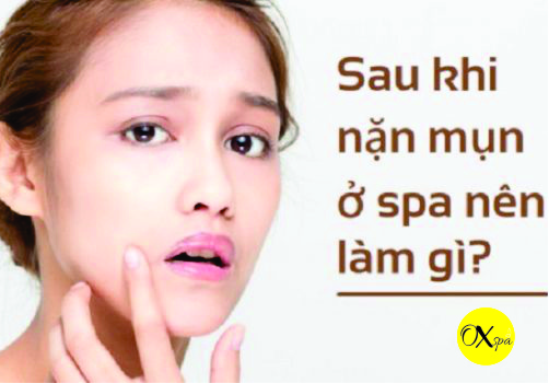 Sau khi nặn mụn có nên bôi kem trị mụn, Oxspa