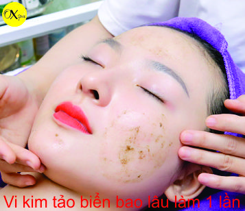 Vi kim tảo biển bao lâu làm 1 lần, Oxspa